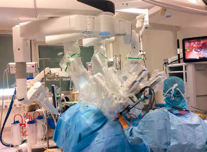chirurgie-robotique-voie-transorale